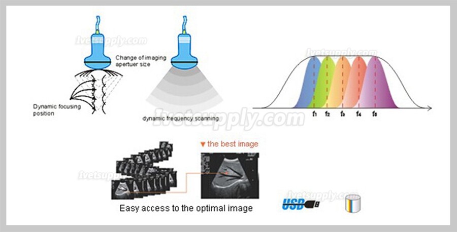 Sonostar SS-5 Portable Multiple Probe Veterinary B/W Ultrasound Scanner For Animal Hospital